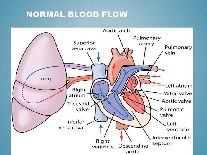 NORMAL BLOOD FLOW 