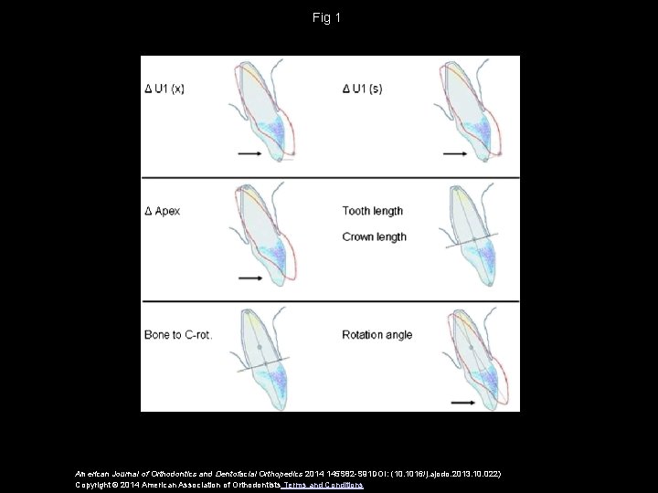 Fig 1 American Journal of Orthodontics and Dentofacial Orthopedics 2014 145 S 82 -S