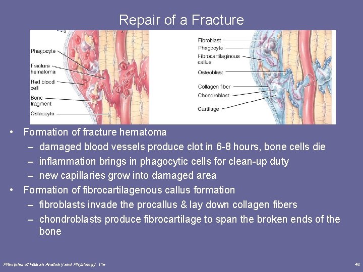 Repair of a Fracture • Formation of fracture hematoma – damaged blood vessels produce
