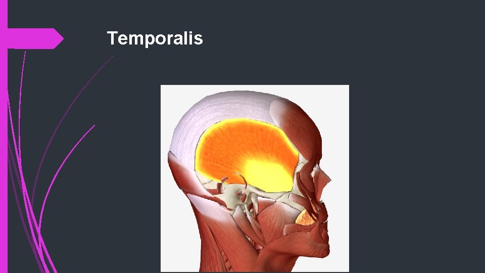 Temporalis 