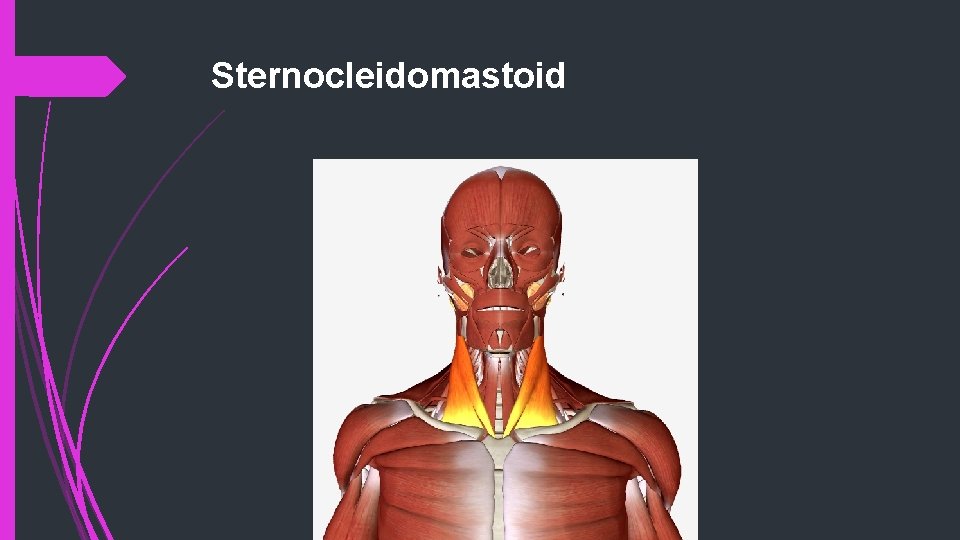 Sternocleidomastoid 