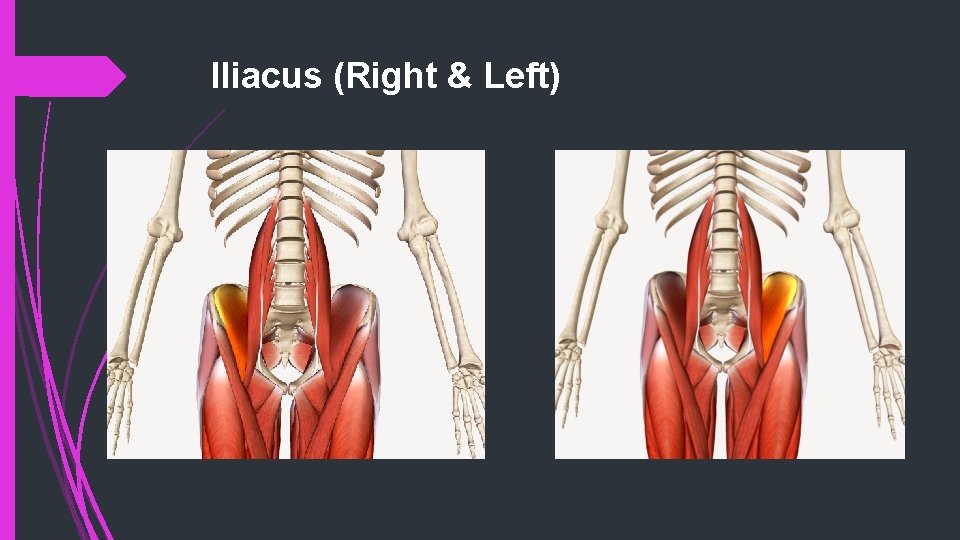 Iliacus (Right & Left) 