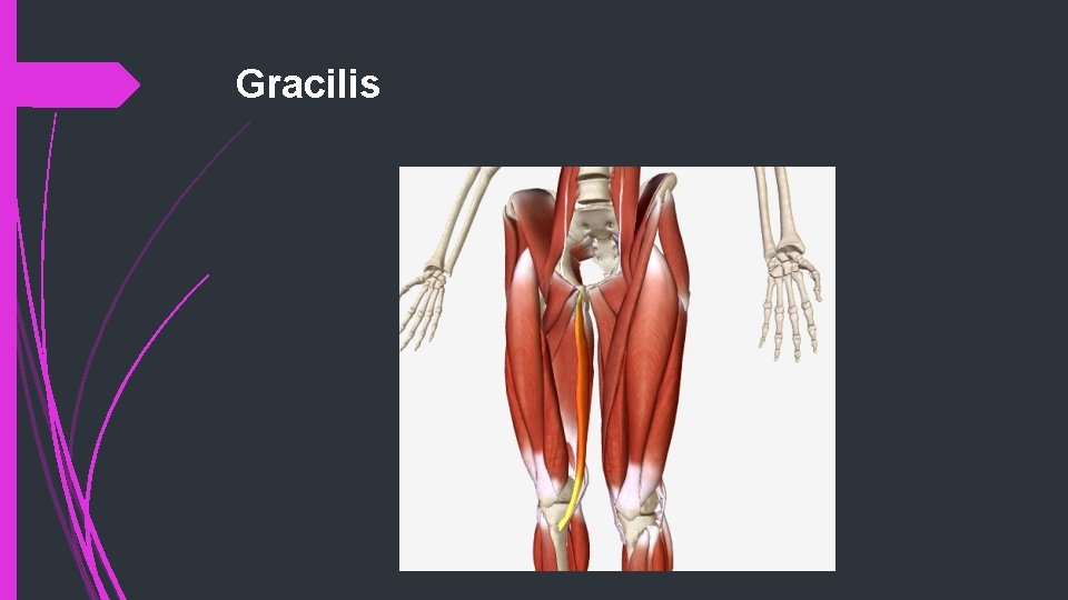 Gracilis 