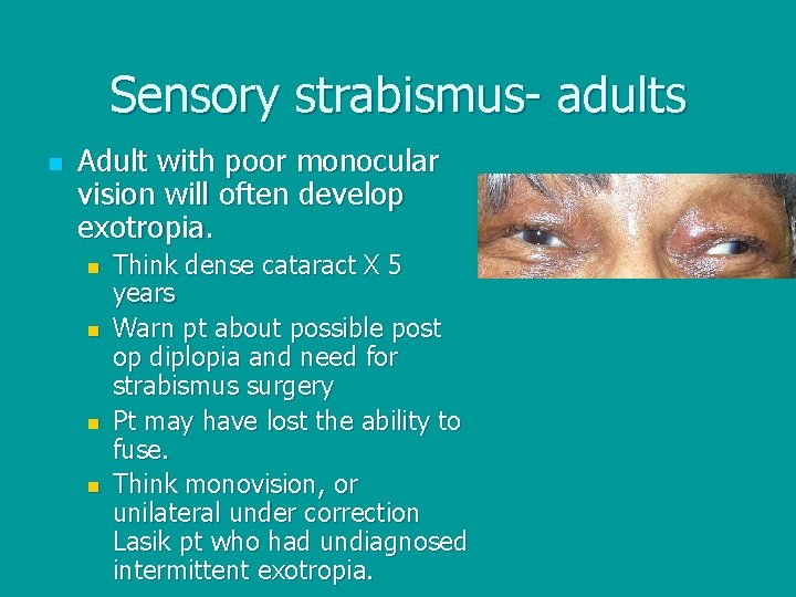 Sensory strabismus- adults n Adult with poor monocular vision will often develop exotropia. n
