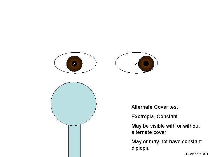 Alternate Cover test Exotropia, Constant May be visible with or without alternate cover May