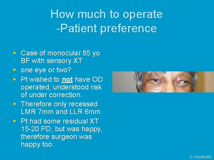 How much to operate -Patient preference § Case of monocular 85 yo BF with