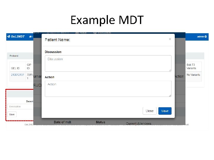 Example MDT 