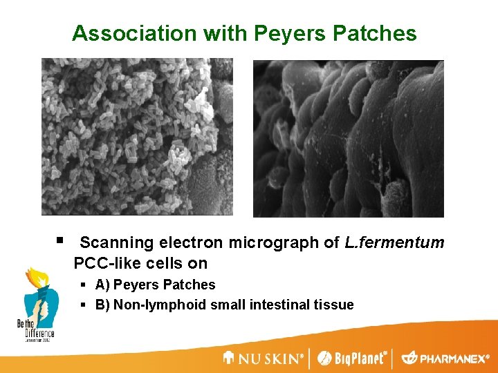 Association with Peyers Patches § Scanning electron micrograph of L. fermentum PCC-like cells on