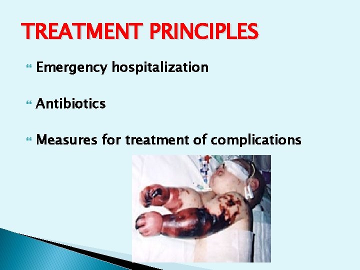 TREATMENT PRINCIPLES Emergency hospitalization Antibiotics Measures for treatment of complications TREATMENT PRINCIPLES Emergency hospitalization Antibiotics Measures for treatment of complications