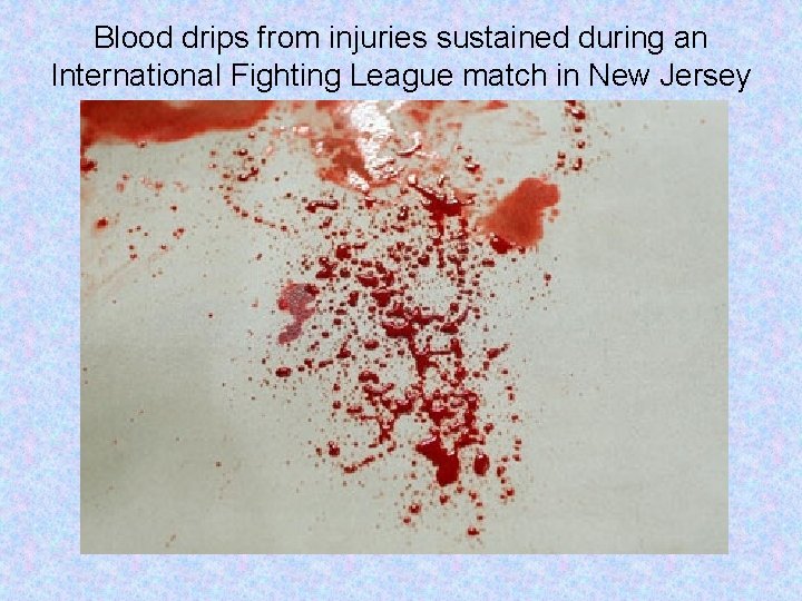 Blood drips from injuries sustained during an International Fighting League match in New Jersey