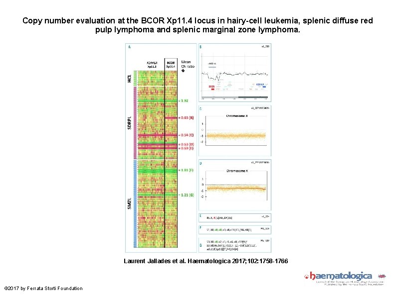Copy number evaluation at the BCOR Xp 11. 4 locus in hairy-cell leukemia, splenic