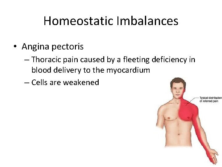 Homeostatic Imbalances • Angina pectoris – Thoracic pain caused by a fleeting deficiency in