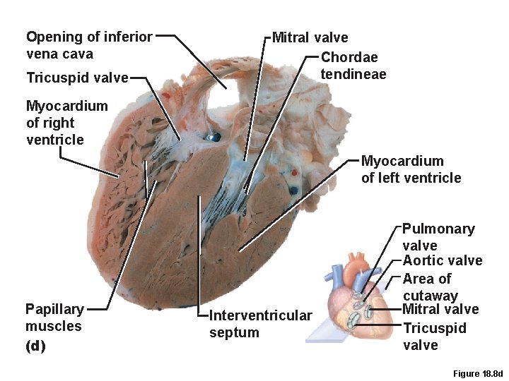 Opening of inferior vena cava Tricuspid valve Mitral valve Chordae tendineae Myocardium of right