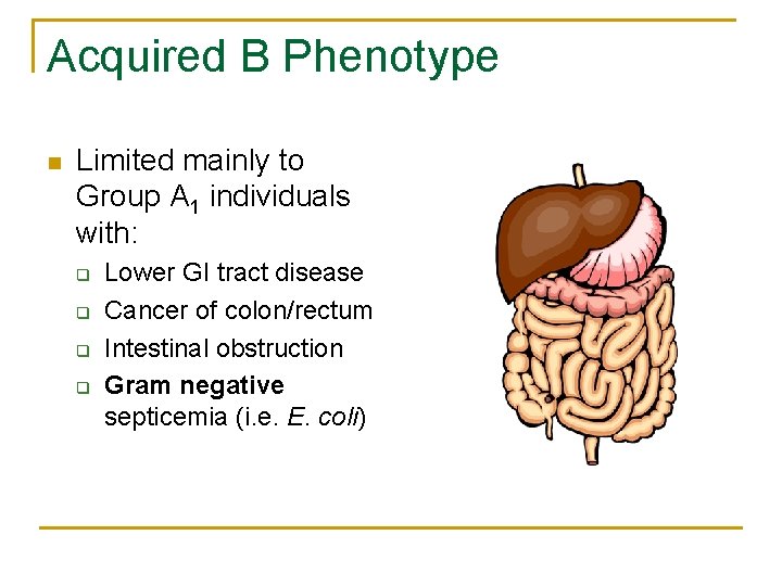 Acquired B Phenotype n Limited mainly to Group A 1 individuals with: q q