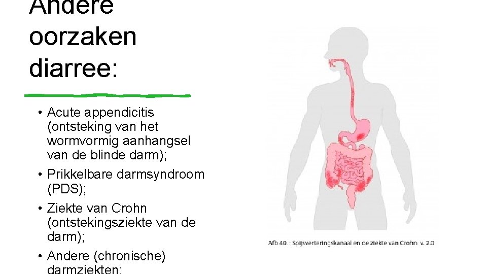 Andere oorzaken diarree: • Acute appendicitis (ontsteking van het wormvormig aanhangsel van de blinde