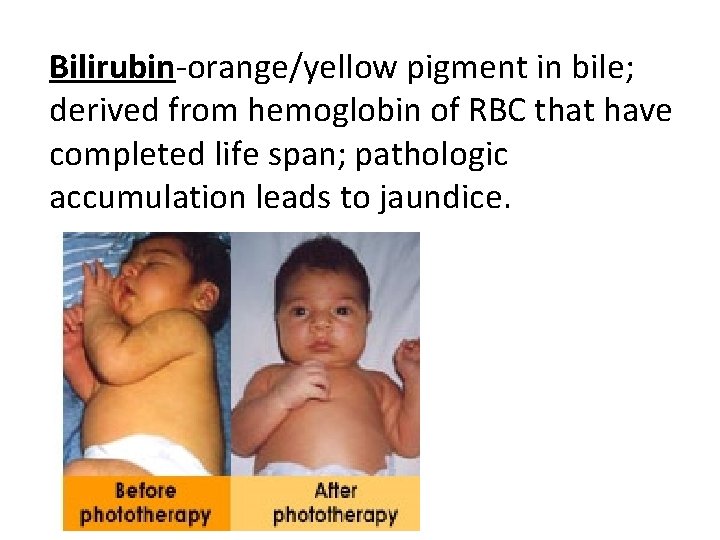 Bilirubin-orange/yellow pigment in bile; derived from hemoglobin of RBC that have completed life span;