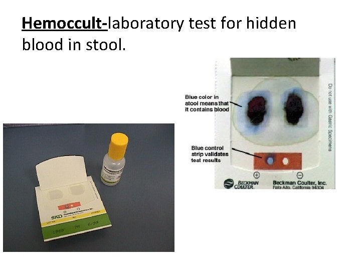 Hemoccult-laboratory test for hidden blood in stool. 