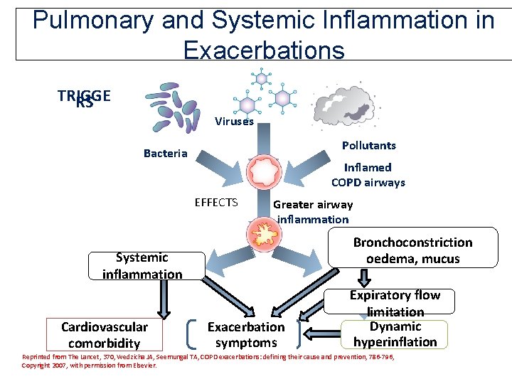 Pulmonary and Systemic Inflammation in Exacerbations TRIGGE RS Viruses Pollutants Bacteria Inflamed COPD airways