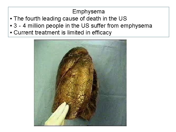 Emphysema • The fourth leading cause of death in the US • 3‐ 4