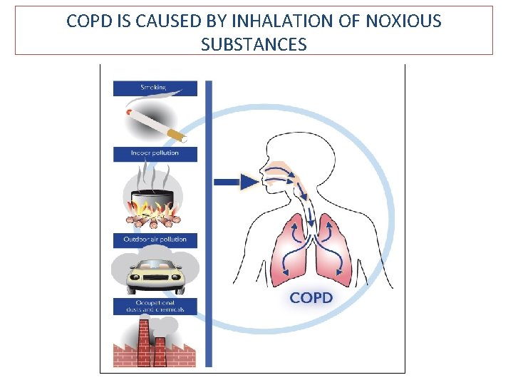 COPD IS CAUSED BY INHALATION OF NOXIOUS SUBSTANCES 