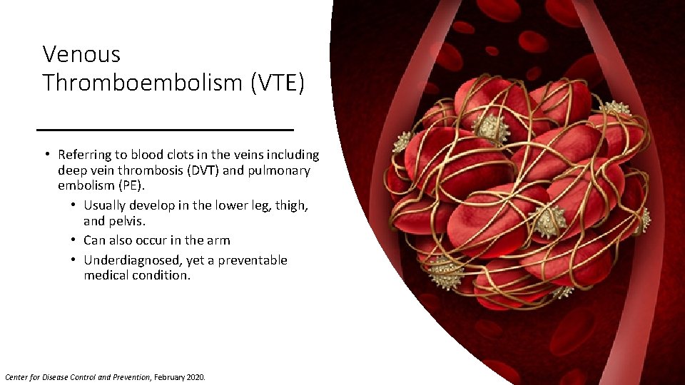 Venous Thromboembolism (VTE) • Referring to blood clots in the veins including deep vein