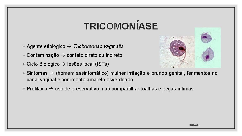 TRICOMONÍASE ◦ Agente etiológico Trichomonas vaginalis ◦ Contaminação contato direto ou indireto ◦ Ciclo