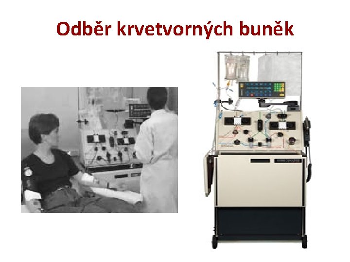 Odběr krvetvorných buněk 