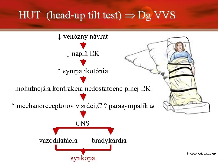 HUT (head-up tilt test) Dg VVS ↓ venózny návrat ↓ náplň ĽK ↑ sympatikotónia