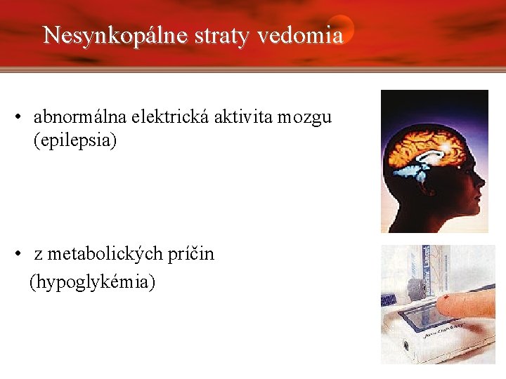 Nesynkopálne straty vedomia • abnormálna elektrická aktivita mozgu (epilepsia) • z metabolických príčin (hypoglykémia)