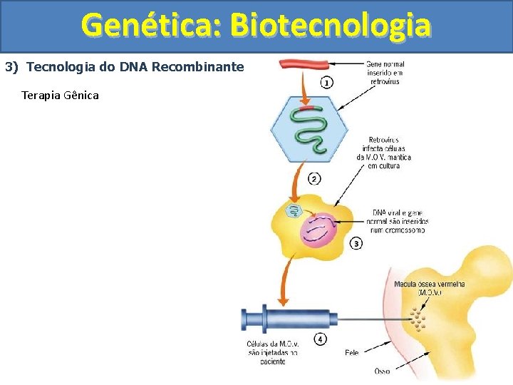 Genética: Biotecnologia 3) Tecnologia do DNA Recombinante Terapia Gênica 