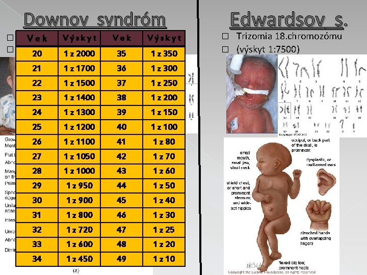 Downov syndróm � � Výskyt Vek Trizomia V e k 21. chromozómu (výskyt 20