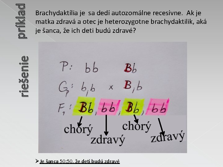 príklad riešenie Brachydaktília je sa dedí autozomálne recesívne. Ak je matka zdravá a otec