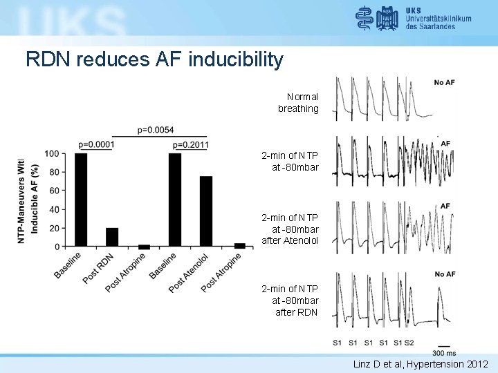 RDN reduces AF inducibility Normal breathing 2 -min of NTP at -80 mbar after