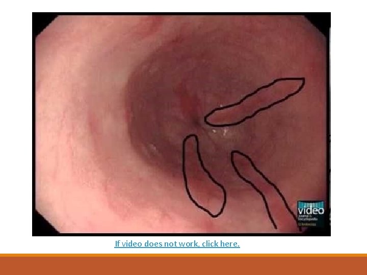 If video does not work, click here. 