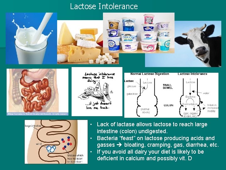 Lactose Intolerance • Lack of lactase allows lactose to reach large intestine (colon) undigested.