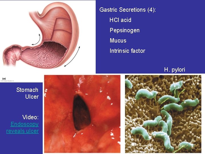 Gastric Secretions (4): HCl acid Pepsinogen Mucus Intrinsic factor H. pylori Stomach Ulcer Video: