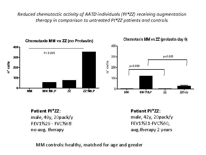 Reduced chemotactic activity of AATD individuals (PI*ZZ) receiving augmentation therapy in comparison to untreated