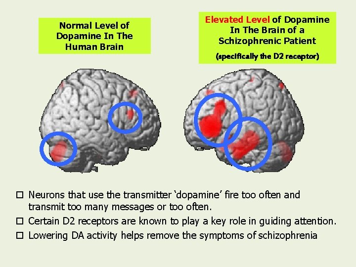 Normal Level of Dopamine In The Human Brain Elevated Level of Dopamine In The