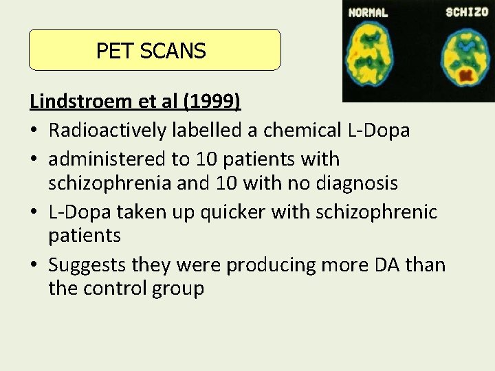 PET SCANS Lindstroem et al (1999) • Radioactively labelled a chemical L-Dopa • administered