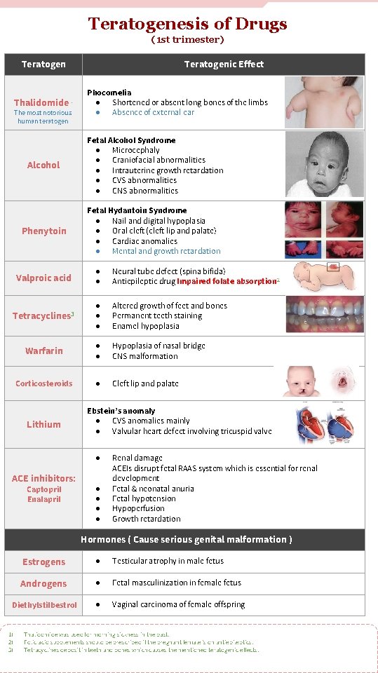 Teratogenesis of Drugs (1 st trimester) Teratogen Thalidomide Teratogenic Effect 1 The most notorious