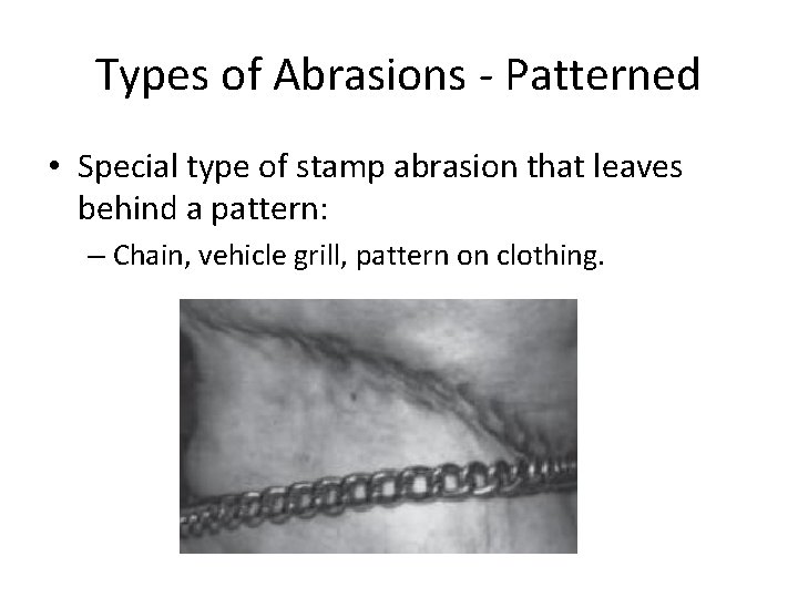 Chapter Five 80 87 Knives and blunt Instruments