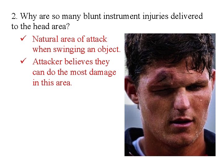 2. Why are so many blunt instrument injuries delivered to the head area? ü