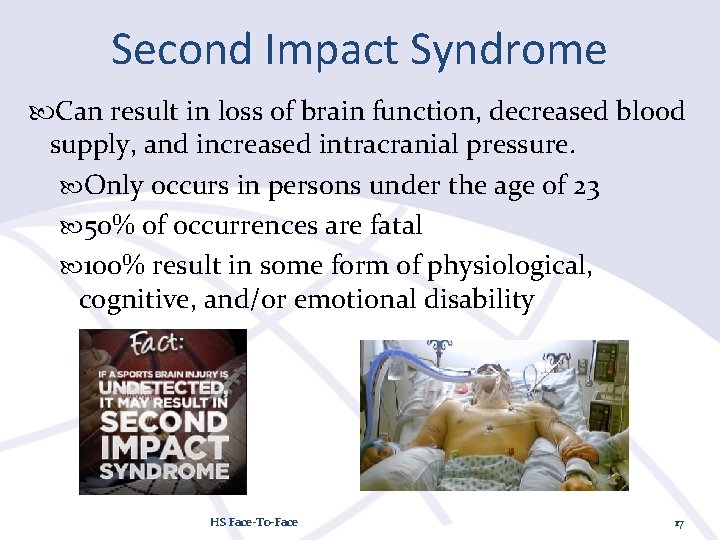 Second Impact Syndrome Can result in loss of brain function, decreased blood supply, and