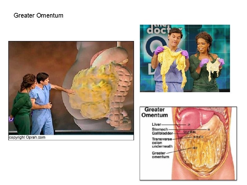 Greater Omentum 