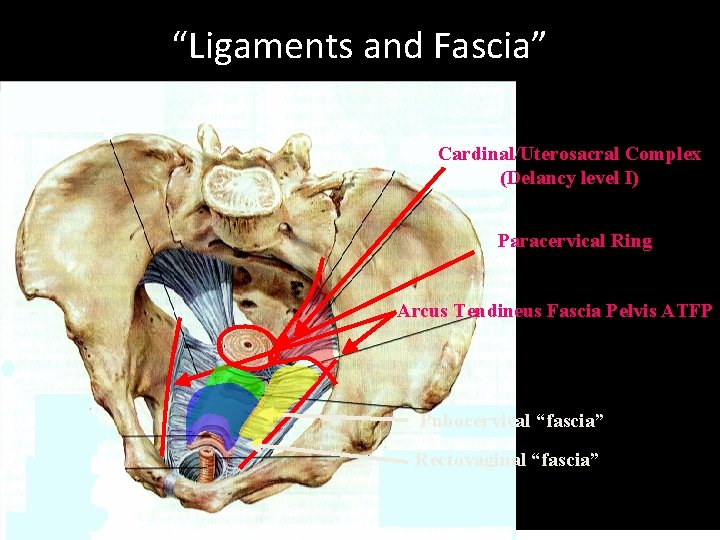 “Ligaments and Fascia” Cardinal/Uterosacral Complex (Delancy level I) Paracervical Ring Arcus Tendineus Fascia Pelvis
