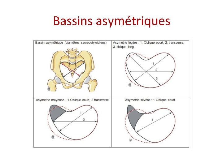 Bassins asymétriques 