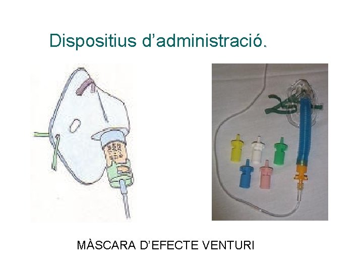 Dispositius d’administració. MÀSCARA D’EFECTE VENTURI 