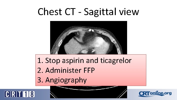 Chest CT - Sagittal view 1. Stop aspirin and ticagrelor 2. Administer FFP 3.