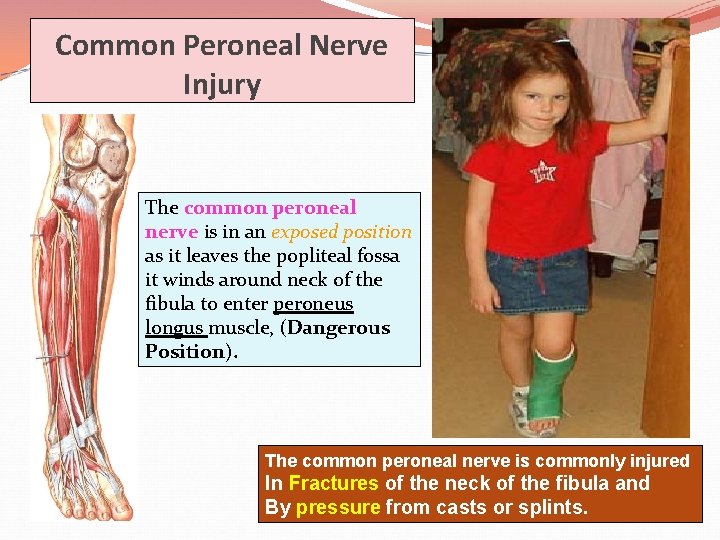 Common Peroneal Nerve Injury The common peroneal nerve is in an exposed position as