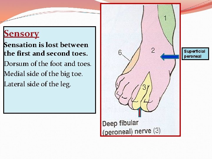 Sensory Sensation is lost between the first and second toes. Dorsum of the foot